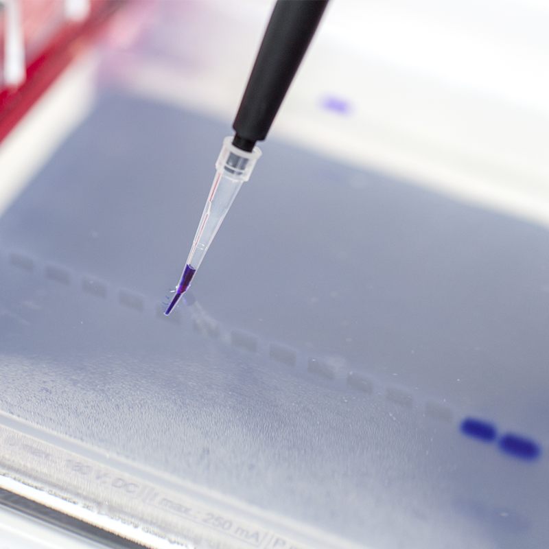 Protein Electrophoresis